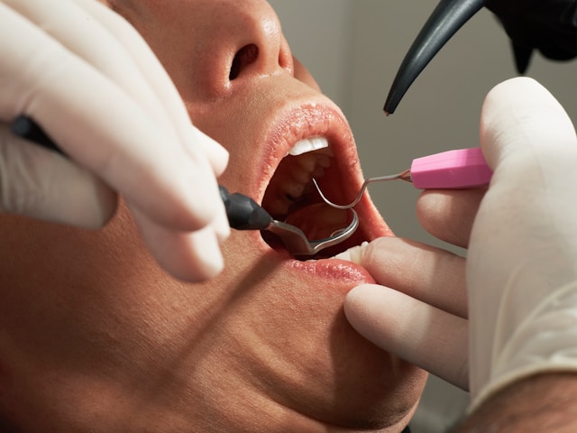 Ilustrasi pemeriksaan gigi di klinik gigi jakarta